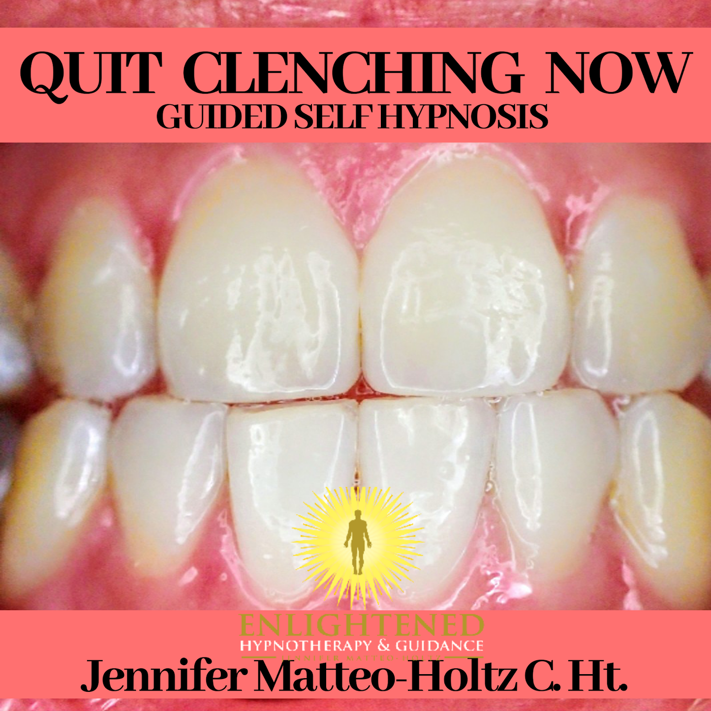Quit Clenching Now! MP3